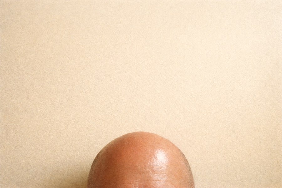 A bald head peeking into frame